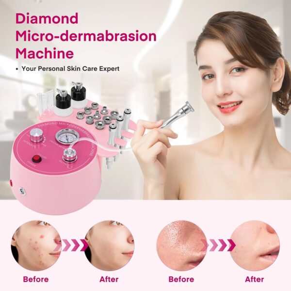 Micro Dermabrasion Machine - Image 2